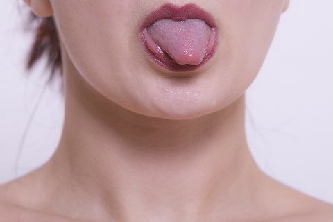 舌 の 裏側 口内炎